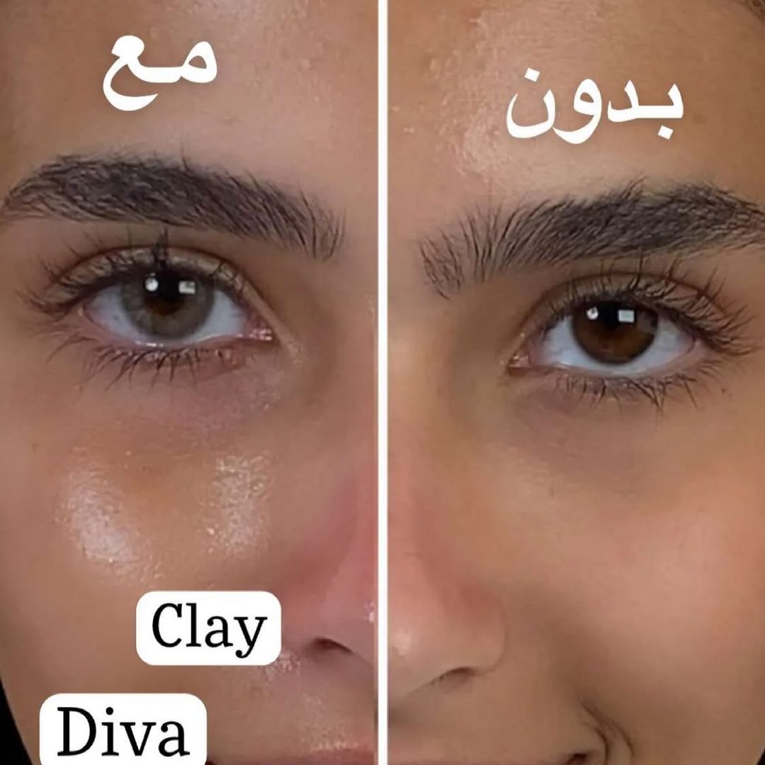 Diva Clay @ ديفا - كلاي Medical (Valid until: 04/2026)